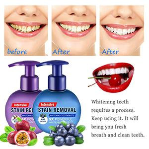 Intensive Stain Removal Whitening Toothpaste