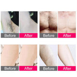 IPL Laser Hair Removal